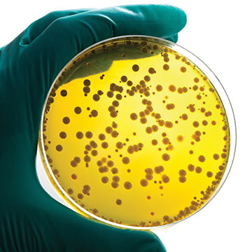 image of gloved hand holding a petri dish of bacterial growth